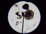 Фораминифера из отр Endothyrida