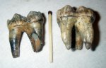 Задние зубы 2