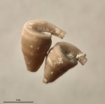 Orthoconorca turricula