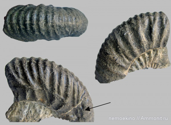 прижизненные повреждения, Сызрань