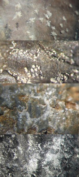 пиритовая болезнь