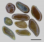 Зубы Pycnodontiformes fam. et gen. indet.