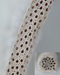 Streblascopora densa (Morozova, 1955)