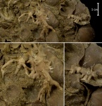 Холдфасты морских лилий