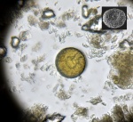 Микросклера губки или радиолярия Orbiculiforma vacaensis Pessagno, 1973 (?)
