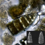 Радиолярия Archaeodictyomitra sp. (?)