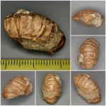 Раковая шейка.